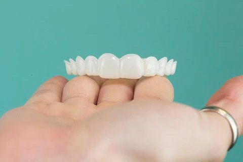 Best pop on veneers - Instasmile Best pop on veneers - Instasmile