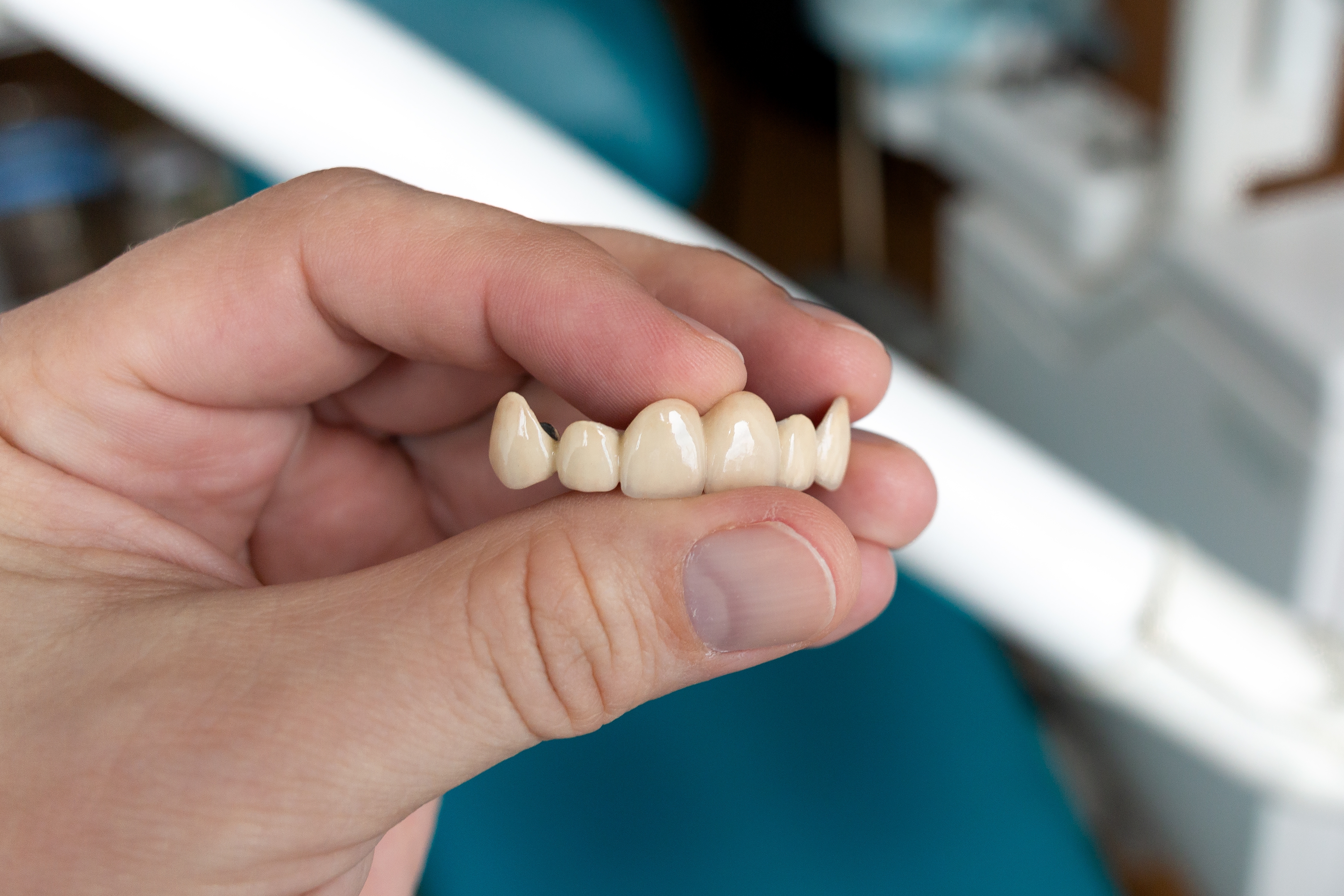Difference between dental implants and dentures Difference between dental implants and dentures