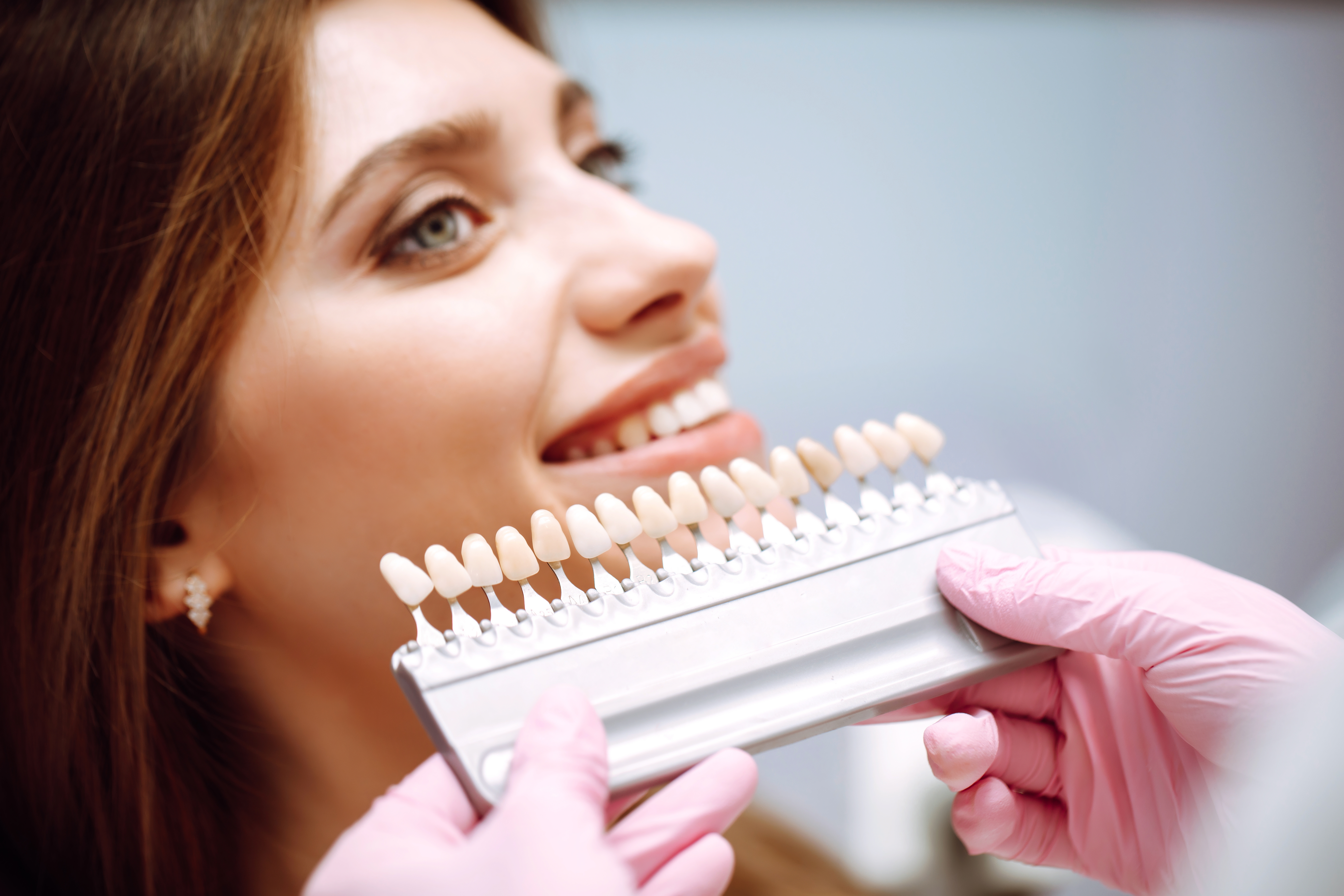 How to get affordable veneers - instasmile How to get affordable veneers - instasmile