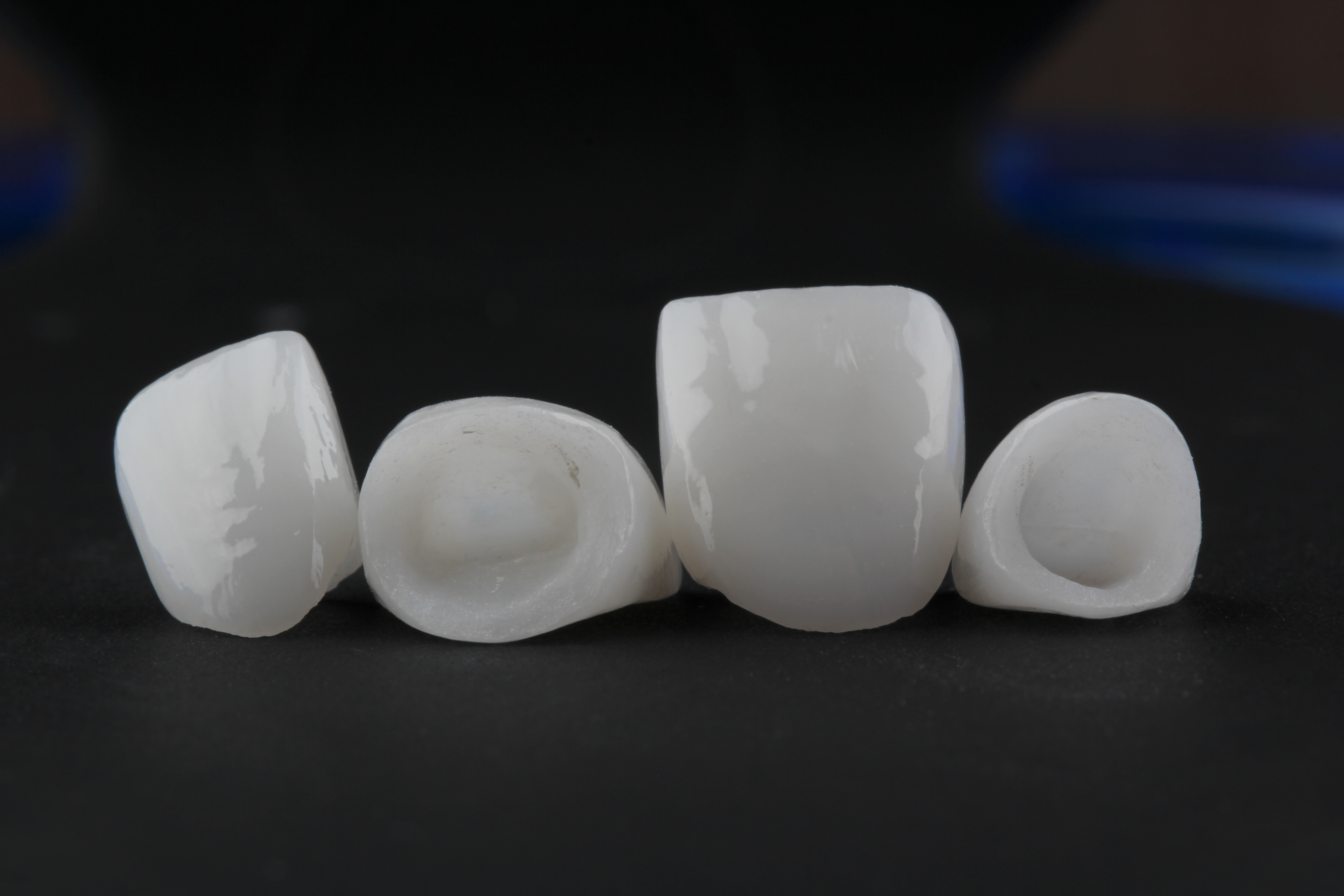 How to tell if your veneers are loose - instasmile How to tell if your veneers are loose - instasmile