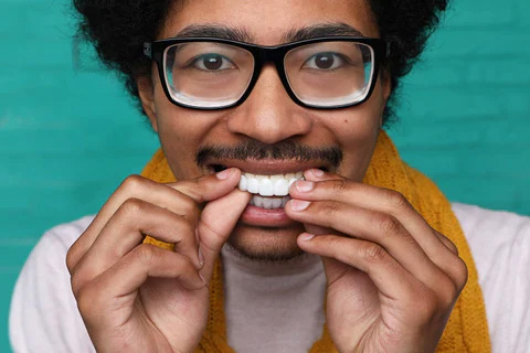 What is Invisalign What is Invisalign