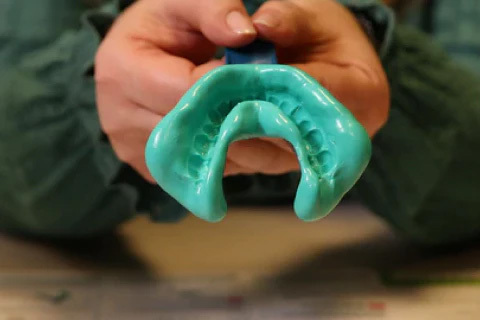 How does dental bonding work How does dental bonding work